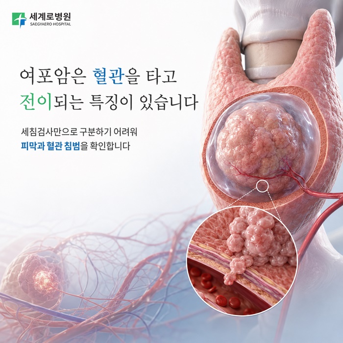 51c76-6aaa9f7fd5afd-3d03bb88ead10481d1750bf87521834666176719.jpg