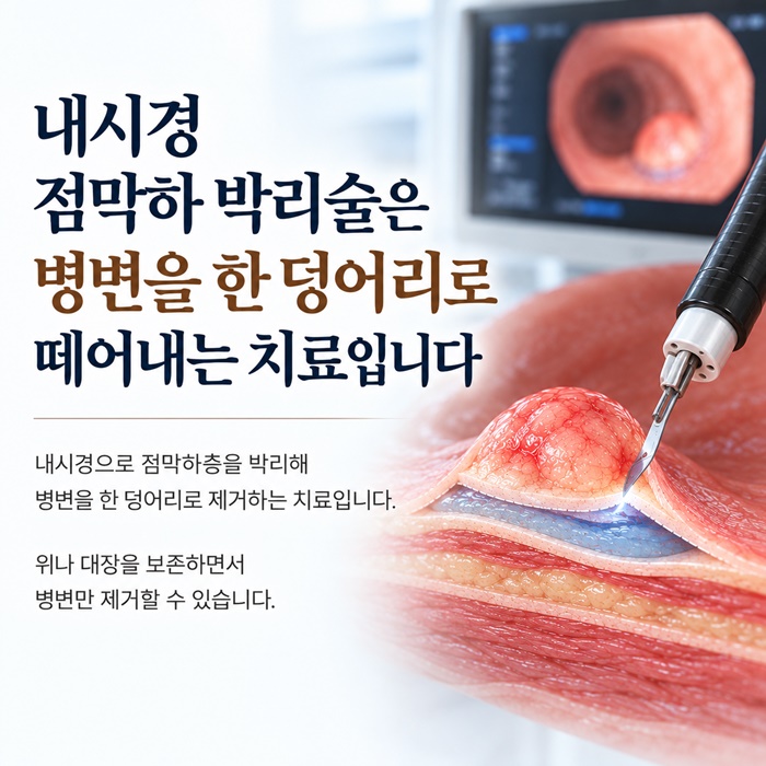 51c76-6ae1606a1e72f-cf8d37a18ada581495b84995ac7bd4056b55af3e.jpg
